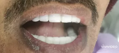 مركز شمس الأردن لطب وزراعة الأسنان د مشعل النمري المفرق