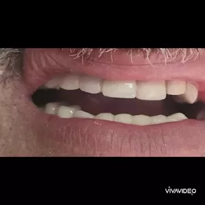مركز شمس الأردن لطب وزراعة الأسنان د مشعل النمري المفرق