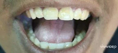 مركز شمس الأردن لطب وزراعة الأسنان د مشعل النمري المفرق