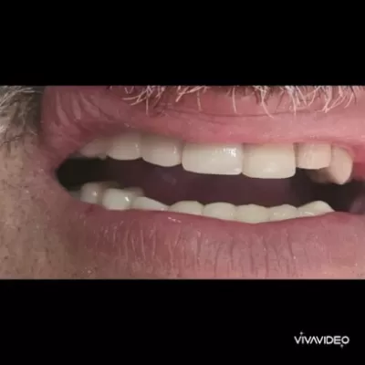 مركز شمس الأردن لطب وزراعة الأسنان د مشعل النمري المفرق