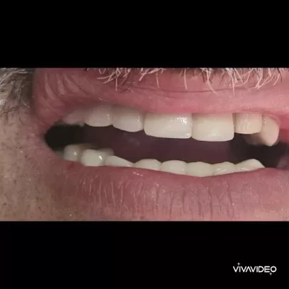 مركز شمس الأردن لطب وزراعة الأسنان د مشعل النمري المفرق