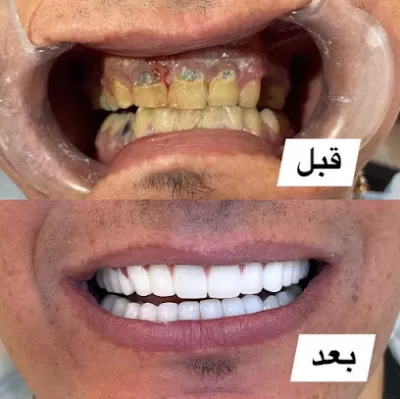 الدكتورة آلاء الحوامدة طب وجراحة الأسنان