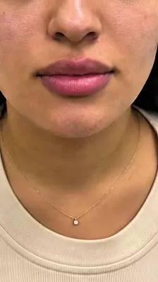 عيادة د. عمار الجراح للأمراض الجلدية والتجميل Dr. Ammar Al-Jarrah Dermatology (Skin) & Aesthetics Clinic