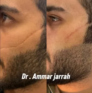 عيادة د. عمار الجراح للأمراض الجلدية والتجميل Dr. Ammar Al-Jarrah Dermatology (Skin) & Aesthetics Clinic