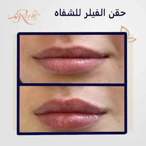 عيادة الدكتورة ريم العوضي أفضل دكتورة جلدية وتجميل
