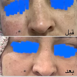 عيادة الدكتورة اماني ابو دعابس أخصائية امراض جلدية