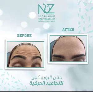 الدكتورة ندى فهيم زايد (الجلدية و التناسلية و التجميل و الليزر)