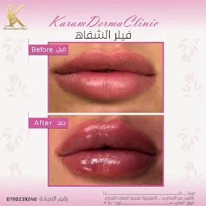 عيادة د.محمد امين المعايطه للجلديه والتجميل والليزر