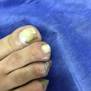 عيادة الدكتورة هيا العيطان للأمراض الجلدية والطب التجميلي والعلاج بالليزر