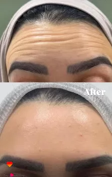 عيادة الدكتور بشار جرار للجلدية والتجميل