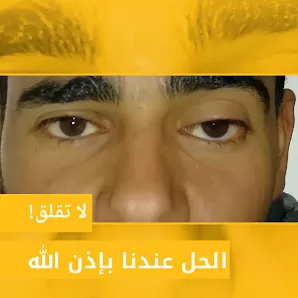 Al-salem Eye Clinic