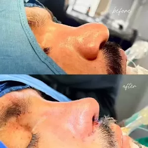 عيادة أنف وأذن وحنجرة