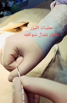 د. نضال شواقفه / استشاري الجراحه العامه و جراحة المنظار و الليزر